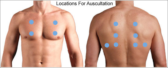 Locations for auscultation